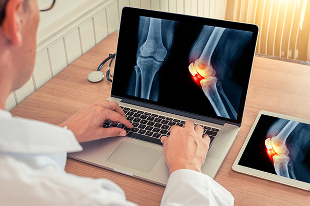 Arzt arbeitet mit Mac an einem Bild mit Knieschmerzen